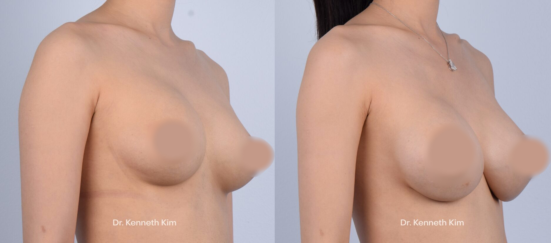 Untitled-design-3-eA