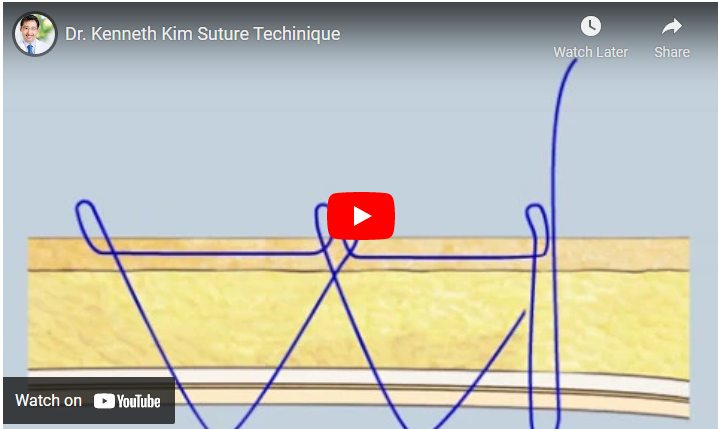 Dr. Kenneth Kim Suture Techinique video