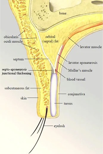 Eyelid Crease 