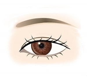 Mild Ptosis sketch image