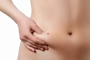Rapid Recovery Tummy Tuck