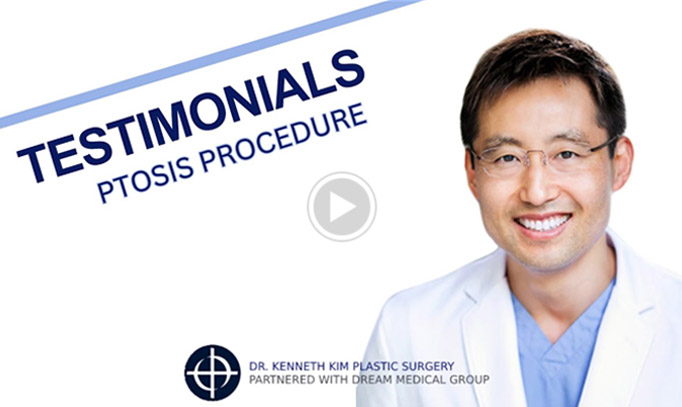 Ptosis Procedure Testimonial Click to See Video