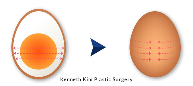 Image of face shape is an oval shape like that of an egg